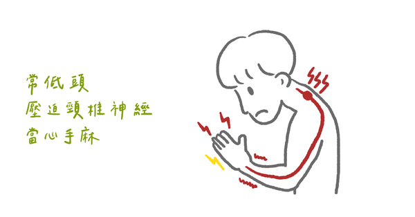 你有手麻困擾嗎?物理治療師:四個手麻常見的原因與特色