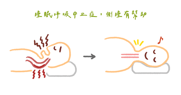 打呼代表睡得好?臨床心理師帶你認識睡眠呼吸中止症 (下)
