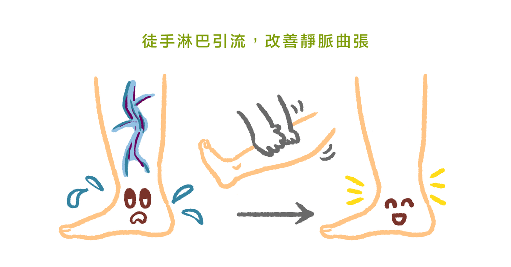 蚯蚓爬上腿？認識俗稱靜脈曲張的慢性靜脈功能不全 - Bestmade 人學院