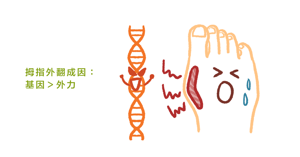 穿尖頭鞋造成拇指外翻？研究指出拇指外翻基因才是主要原因 - Bestmade 人學院