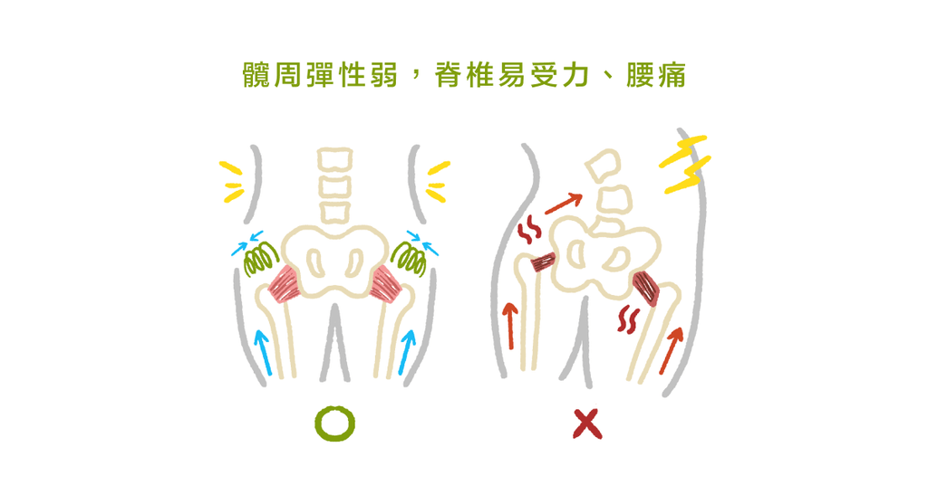 腰痛膝蓋痛，有可能是髖關節失能導致 - Bestmade 人學院