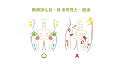 腰痛膝蓋痛,有可能是髖關節失能導致