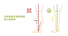 身體不出力讓膝蓋過度往後推,小心膝超伸找上門