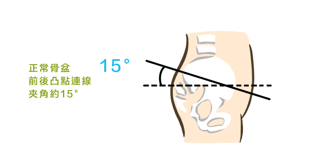 總是腰痛？物理治療師教你如何改善骨盆後傾（上） - Bestmade 人學院